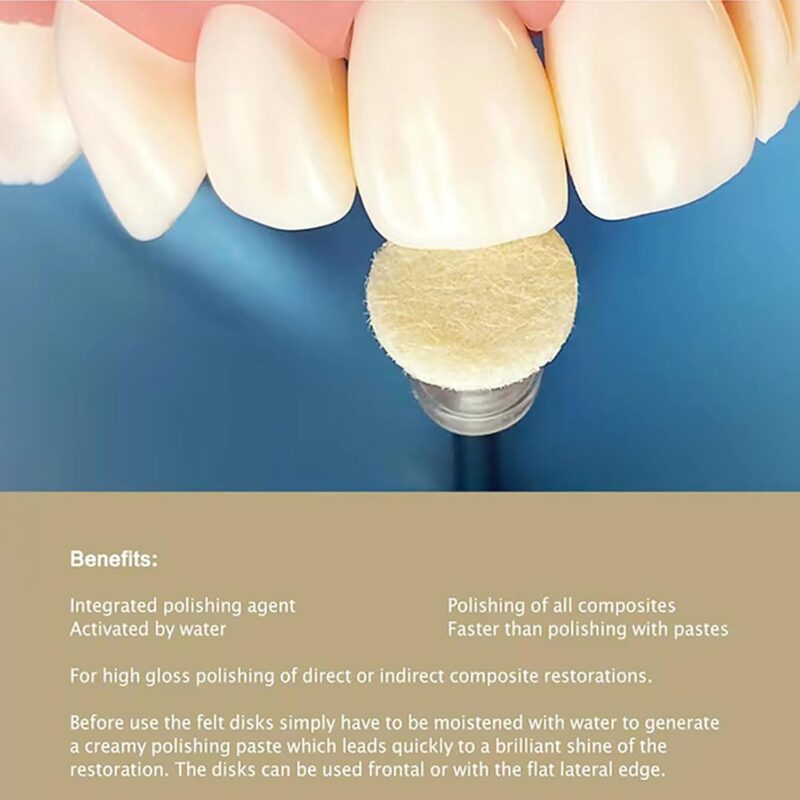 EZ Smile Polishing Paste-Impregnated Snap on Felt Kit - Image 6