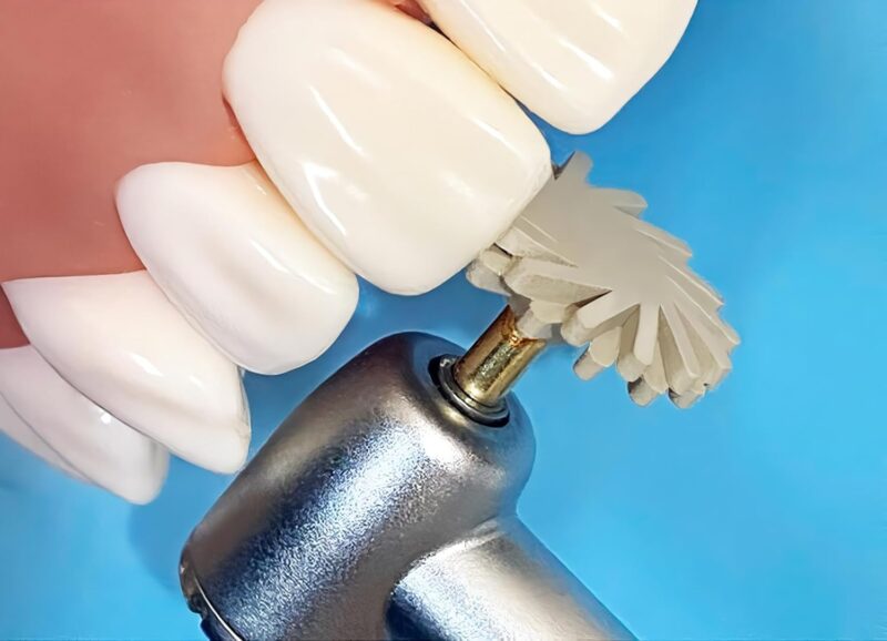 Ez Dental 2 Step Composite Spiral Polishing Kit - Image 9